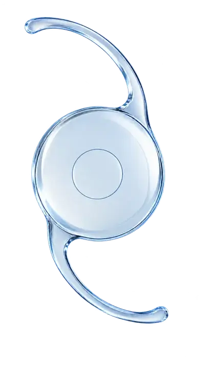 Ilustración de una lente intraocular EDOF de foco extendido. Imagen genérica, sin identificar un modelo comercial.