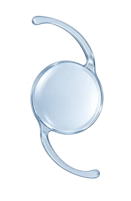 Ilustración de una lente intraocular con sus dos soportes curvos. Imagen genérica, sin identificar un modelo comercial.