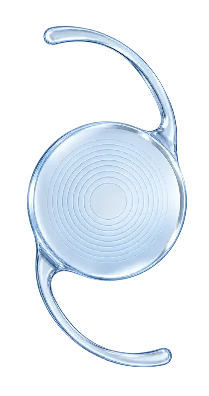 Ilustración de una lente intraocular trifocal con anillos concéntricos. Imagen genérica, sin identificar un modelo comercial.